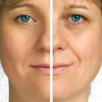 Top 10 Benefits of Collagen Peptides